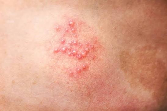 stds_dermatologos